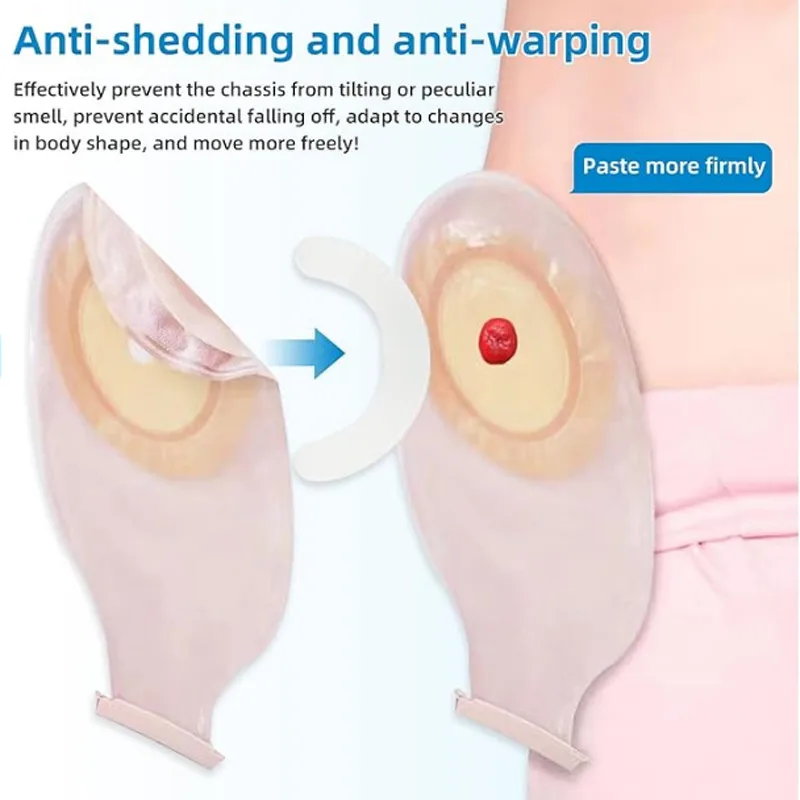 Medical Ostomy Bag Reinforceme - огляд і ціна Medical Tape